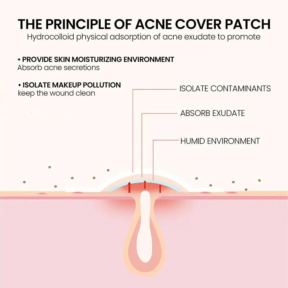 🌟 StarGlow Acne Patch – Cute, Powerful, and Skin-Friendly