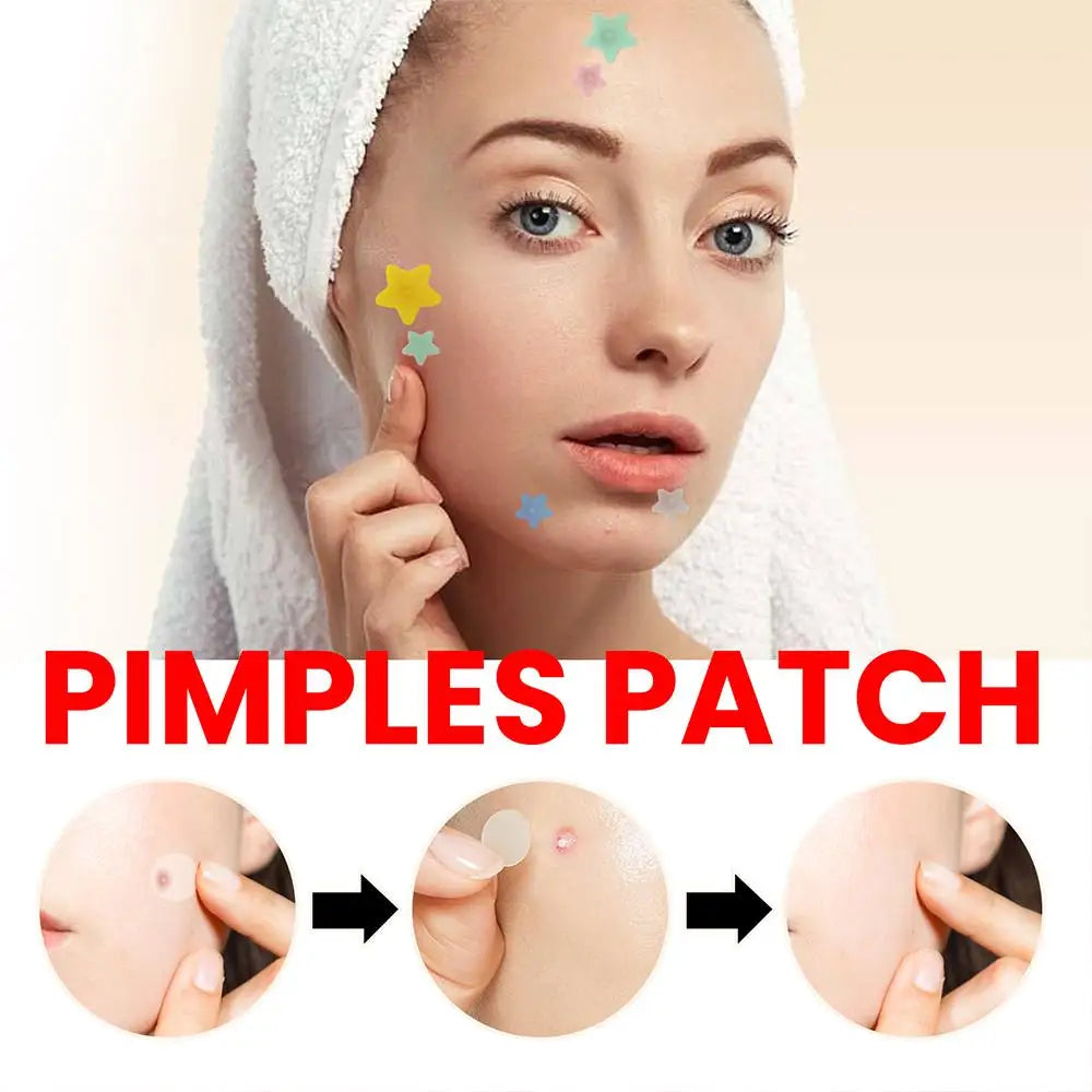 🌟 StarGlow Acne Patch – Cute, Powerful, and Skin-Friendly
